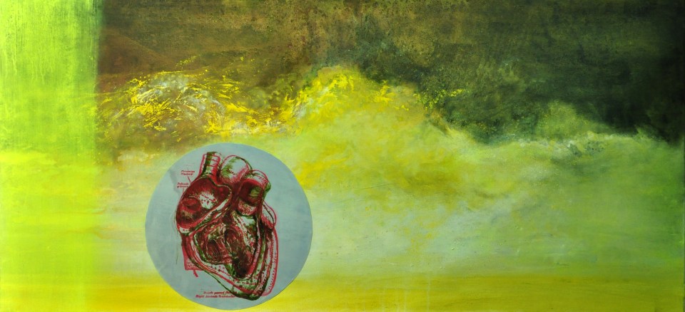 Acrílico, estampación sobre tela y aluminio.